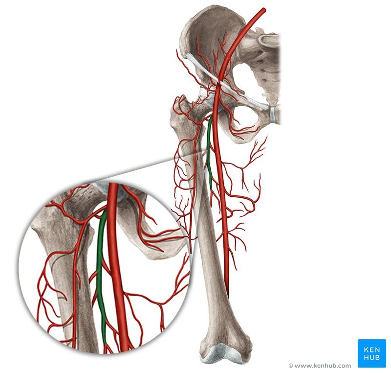 femoral
